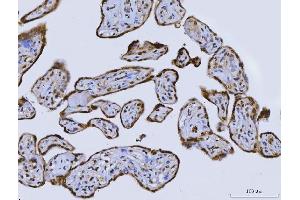 IHC analysis of CUX1 using anti-CUX1 antibody (ABIN7599103).