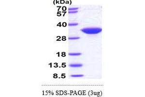 SDS-PAGE (SDS) image for Inositol(myo)-1(or 4)-Monophosphatase 1 (IMPA1) (AA 1-277) protein (His tag) (ABIN667229)