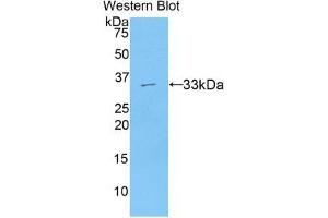 Western blot analysis of the recombinant protein. (AXIN2 anticorps  (AA 350-631))