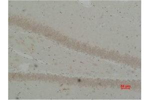 Immunohistochemical analysis of paraffin-embedded Rat Brain Tissue using BEST2 Polyclonal Antibody. (Bestrophin 2 anticorps)