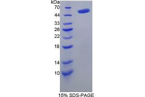 SDS-PAGE analysis of Rat TP Protein.
