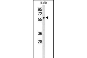 Western blot analysis of PLV Antibody (Center) 9378c in HL-60 cell line lysates (35 μg/lane). (PLVAP anticorps  (AA 214-242))