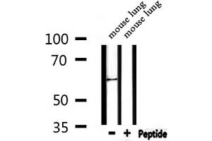 Western blot analysis of extracts from mouse lung , using Keratin 9 Antibody.