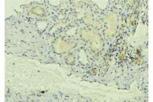ABIN6277709 at 1/100 staining Mouse kidney tissue by IHC-P. (Chloride Channel 5 anticorps  (Internal Region))