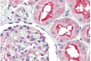 Human Kidney (formalin-fixed, paraffin-embedded) stained with ATG7 antibody ABIN307176 at 5 ug/ml followed by biotinylated goat anti-rabbit IgG secondary antibody ABIN481713, alkaline phosphatase-streptavidin and chromogen. (ATG7 anticorps  (N-Term))