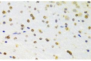 Immunohistochemistry of paraffin-embedded Rat brain using DOK1 Polyclonal Antibody at dilution of 1:100 (40x lens).