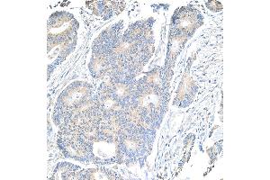 Immunohistochemistry (IHC) image for anti-Notch 1 (NOTCH1) (AA 2505-2555) antibody (ABIN7454790) (Notch1 anticorps  (AA 2505-2555))