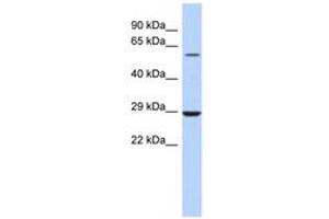 Image no. 1 for anti-Lysophosphatidylcholine Acyltransferase 1 (LPCAT1) (AA 323-372) antibody (ABIN6743531) (LPCAT1 anticorps  (AA 323-372))