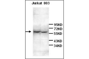 Western Blot analysis of Jurkat and 803 cell lysates with anti-IL6R antibody at 1/200 dilution (IL-6 Receptor anticorps)