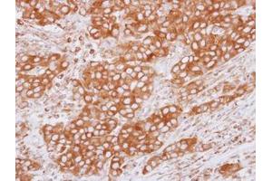 Image no. 1 for anti-Tubulin, beta 2C (TUBB2C) (Internal Region) antibody (ABIN1493535)