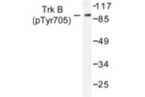 Image no. 1 for anti-Neurotrophic Tyrosine Kinase, Receptor, Type 2 (NTRK2) (pTyr705) antibody (ABIN318147) (TRKB anticorps  (pTyr705))