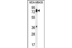 Western blot analysis in MDA-MB435 cell line lysates (35ug/lane). (PCDHB13 anticorps  (AA 273-300))