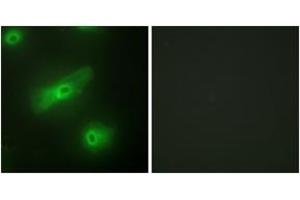 Immunofluorescence analysis of HeLa cells, using TALL-2 Antibody.