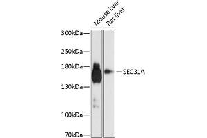 Western blot analysis of extracts of various cell lines, using SEC31A antibody (ABIN6132940, ABIN6147491, ABIN6147492 and ABIN6224974) at 1:1000 dilution. (SEC31A anticorps  (AA 300-500))