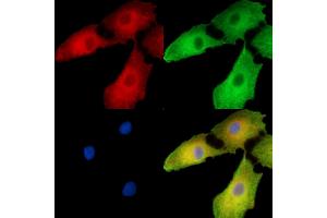 ABIN7096260 and ABIN7100322 staining  cells by IF/ICC. (Ubiquinol-Cytochrome C Reductase Complex Chaperone (UQCC) anticorps)