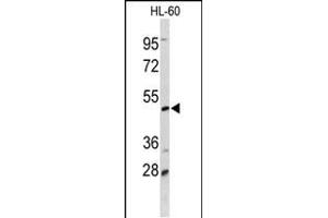 Western blot analysis of DCP2 Antibody (Center) (ABIN653129 and ABIN2842708) in HL-60 cell line lysates (35 μg/lane). (DCP2 anticorps  (AA 144-173))