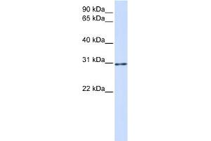WB Suggested Anti-AKT1S1 Antibody Titration:  0.