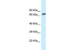 WB Suggested Anti-Btrc Antibody   Titration: 1.