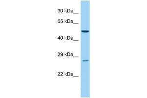 Host:  Rabbit  Target Name:  Cyp4b1  Sample Type:  Mouse Testis lysates  Antibody Dilution:  1. (CYP4B1 anticorps  (C-Term))