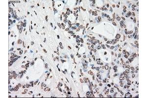 Image no. 11 for anti-Polo-Like Kinase 1 (PLK1) antibody (ABIN1500281)