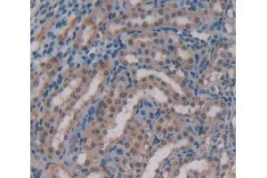 Used in DAB staining on fromalin fixed paraffin- embedded kidney tissue