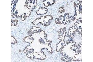 IHC analysis of Cytokeratin 8/KRT8 using anti-Cytokeratin 8/KRT8 antibody (ABIN5518853).
