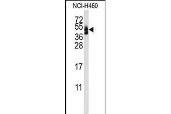 Coxsackie Adenovirus Receptor antibody  (AA 132-161)