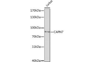 Western blot analysis of extracts of Jurkat cells, using C Rabbit pAb (ABIN7266034) at 1:1000 dilution. (Calpain 7 anticorps  (AA 20-220))