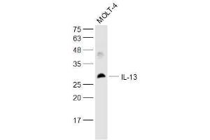 Molt-4 lysates probed with IL-13 Polyclonal Antibody, Unconjugated  at 1:500 dilution and 4˚C overnight incubation. (IL-13 anticorps  (AA 45-56))