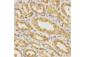 Immunohistochemistry of paraffin-embedded human kidney using CDC42 Antibody (ABIN5970534) at dilution of 1/200 (40x lens). (CDC42 anticorps)