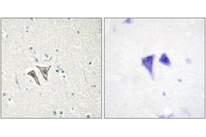 Immunohistochemistry (IHC) image for anti-Activin Receptor Type 1C (ACVR1C) (AA 201-250) antibody (ABIN2889678) (ACVR1C/ALK7 anticorps  (AA 201-250))