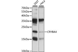 Western blot analysis of extracts of various cell lines, using CRYB antibody (ABIN7266530) at 1:1000 dilution. (CRYbA4 anticorps  (AA 1-196))