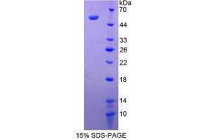 Image no. 1 for Serpin Family C Member 1 (SERPINC1) (AA 33-465) protein (His tag) (ABIN6238611) (SERPINC1 Protein (AA 33-465) (His tag))