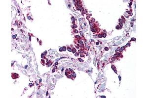 SFTPC antibody was used for immunohistochemistry at a concentration of 4-8 ug/ml. (Surfactant Protein C anticorps  (N-Term))