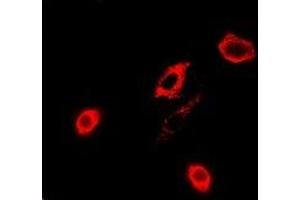 Immunofluorescent analysis of GPx-4 staining in A549 cells. (GPX4 anticorps)