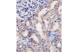(ABIN655076 and ABIN2844708) staining HTR2B in human kidney tissue sections by Immunohistochemistry (IHC-P - paraformaldehyde-fixed, paraffin-embedded sections). (Serotonin Receptor 2B anticorps  (C-Term))