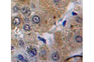 Used in DAB staining on fromalin fixed paraffin-embedded Liver tissue (Caspase 8 anticorps  (AA 385-479))