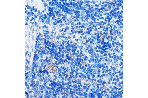 Immunohistochemistry of paraffin-embedded Mouse spleen using HC Rabbit pAb (ABIN7267805) at dilution of 1:100 (40x lens). (GPR109B anticorps)