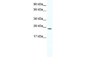 WB Suggested Anti-HOXB7 Antibody Titration:  1. (HOXB7 anticorps  (Middle Region))