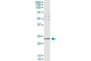 Immunoprecipitation of CD69 transfected lysate using anti-CD69 monoclonal antibody and Protein A Magnetic Bead , and immunoblotted with CD69 MaxPab rabbit polyclonal antibody.