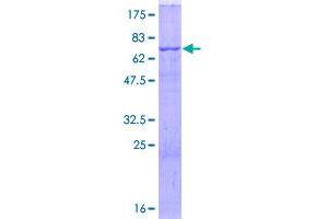 Image no. 1 for CD36 (CD36) (AA 1-472) protein (GST tag) (ABIN1348621)