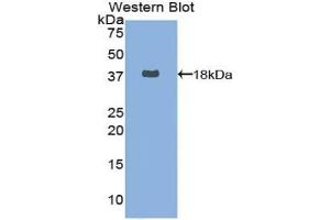 Detection of Recombinant FASN, Human using Polyclonal Antibody to Fatty Acid Synthase (FASN) (Fatty Acid Synthase anticorps  (AA 26-78))