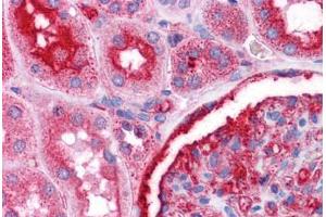 Human Kidney: Formalin-Fixed, Paraffin-Embedded (FFPE)