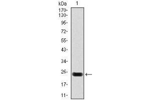 Western blot analysis using troponin T2 mAb against human troponin T2 (AA: 88-249) recombinant protein. (Cardiac Troponin T2 anticorps)