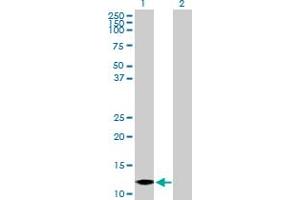 Western Blot analysis of MTPN expression in transfected 293T cell line by MTPN MaxPab polyclonal antibody. (MTPN anticorps  (AA 1-118))