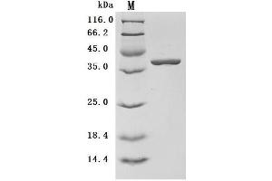 Arginase, Liver (ARG1) (AA 1-322), (full length) (Active) protein (His tag)