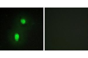 Peptide - +Immunofluorescence analysis of HUVEC cells, using hnRNP C1/C2 antibody. (HNRNPC anticorps  (Internal Region))