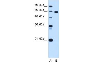 WB Suggested Anti-TBX15 Antibody Titration:  1. (T-Box 15 anticorps  (C-Term))