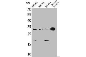 Western Blot analysis of SW480 SKOV3 BT474 mouse heart cells using FGF-18 Polyclonal Antibody