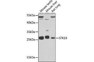 Western blot analysis of extracts of various cell lines, using STK19 antibody (ABIN6132689, ABIN6148598, ABIN6148600 and ABIN6217358) at 1:1000 dilution. (STK19 anticorps  (AA 75-364))